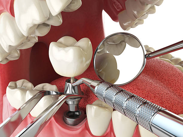 Best Broken or Cracked Tooth Emergency Dentist in Pleasantville, IA